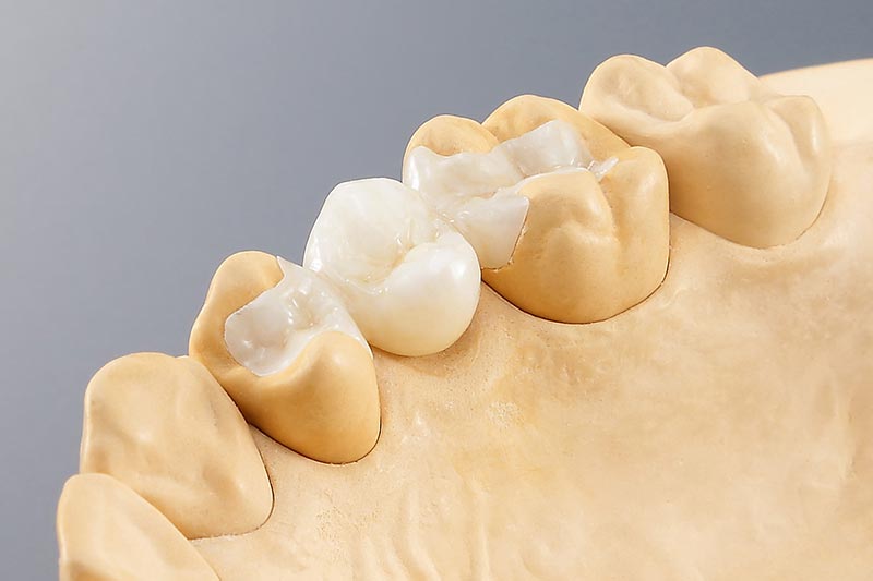 Dental CAD CAM | Roland DG