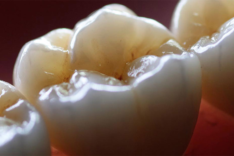 DWX-4W wet dental mill